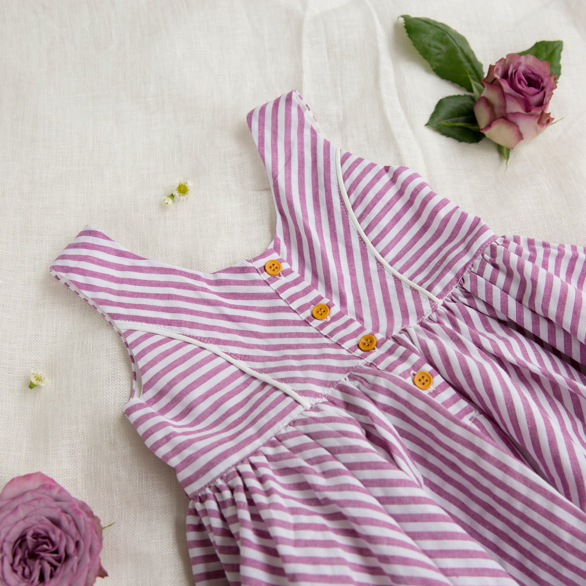 Misty Dress For Sturge Weber Syndrome